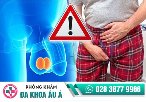 Nguyên nhân apxe tinh hoàn là gì